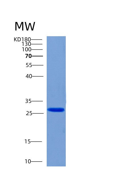Human CHMP6 (Charged Multivesicular Body Protein 6) - Recombinant Protein