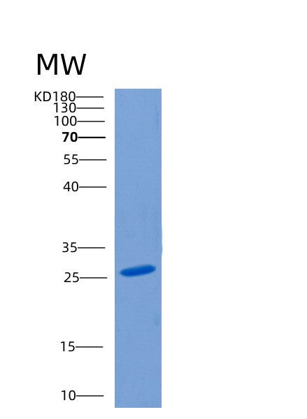 Human CLEC10A (C-Type Lectin Domain Family 10 Member A) - Recombinant Protein
