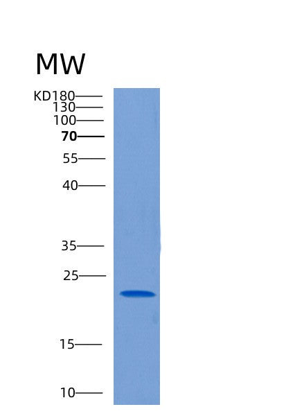 Human CLEC1B (C-Type Lectin Domain Family 1 Member B) - Recombinant Protein