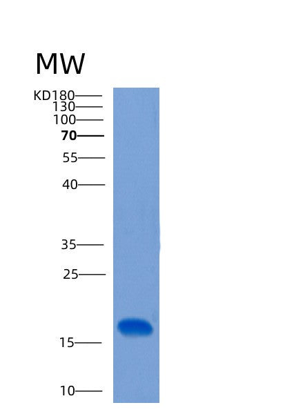 Human CLEC2B (C-Type Lectin Domain Family 2 Member B) - Recombinant Protein
