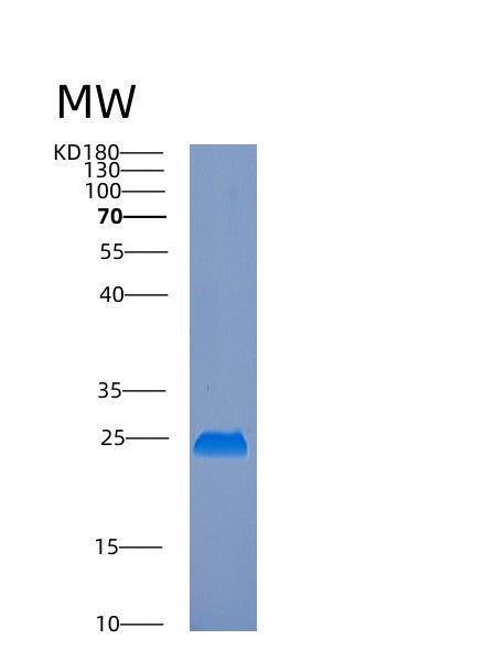 Human EMC8 (Er Membrane Protein Complex Subunit 8) - Recombinant Protein