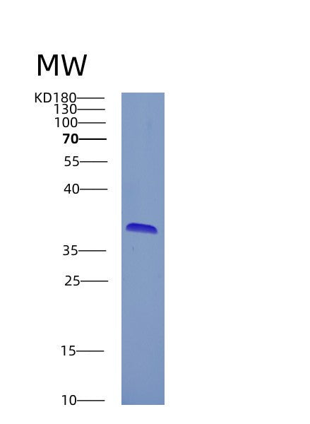 Human CRYZ (Quinone Oxidoreductase) - Recombinant Protein