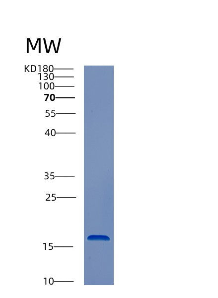 Human CST1 (Cystatin-Sn) - Recombinant Protein