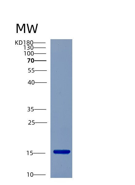 Human CST7 (Cystatin-F) - Recombinant Protein