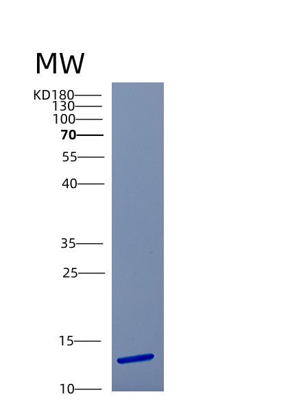 Human CSTB (Cystatin-B) - Recombinant Protein