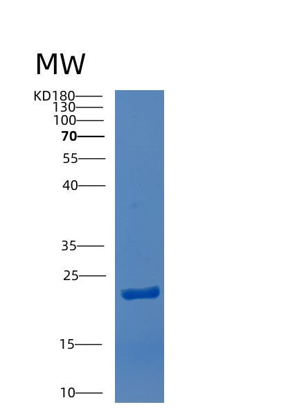 Human CTDSPL (Ctd Small Phosphatase-Like Protein) - Recombinant Protein