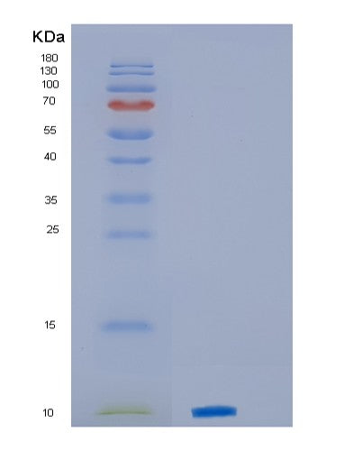Human PF4 (Platelet Factor 4) - Recombinant Protein