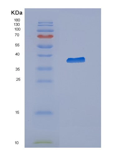 Human CYTH3 (Cytohesin-3) - Recombinant Protein