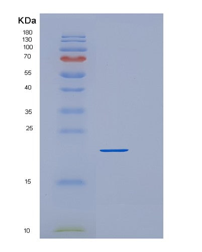 Human DBNDD1 (Dysbindin Domain-Containing Protein 1) - Recombinant Protein