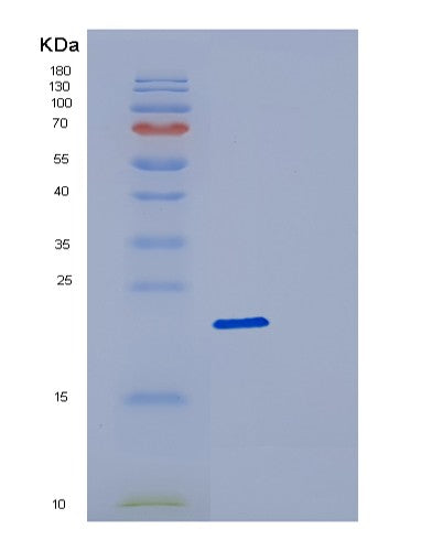 Human DCTD (Deoxycytidylate Deaminase) - Recombinant Protein