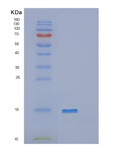 Human DDT (D-Dopachrome Decarboxylase) - Recombinant Protein
