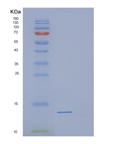 Human DEFB118 (Defensin Beta 118) - Recombinant Protein