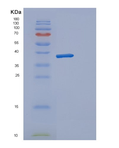 Human DERA (Deoxyribose-Phosphate Aldolase) - Recombinant Protein