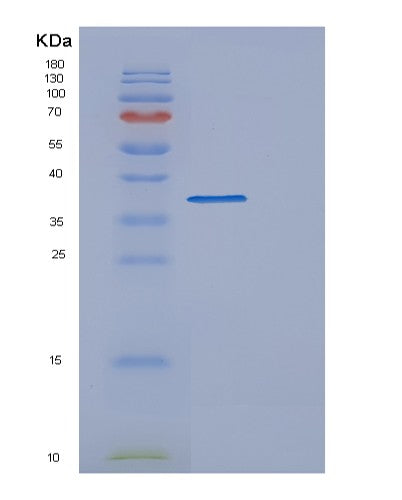 Human DFFA (Dna Fragmentation Factor Subunit Alpha) - Recombinant Protein