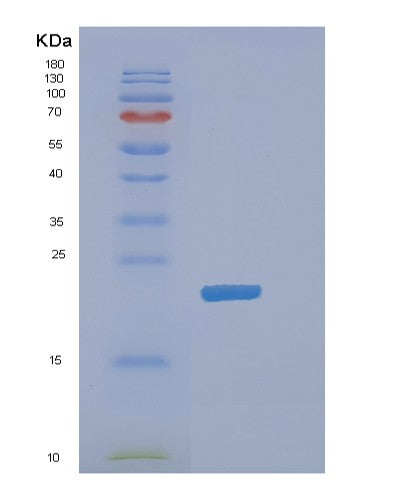 Mouse Dhfr (Dihydrofolate Reductase) - Recombinant Protein