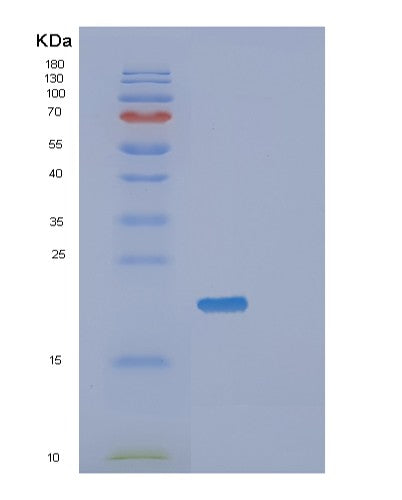 Human SAT1 (Diamine Acetyltransferase 1) - Recombinant Protein