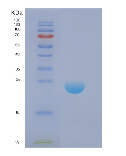 Human DIRAS1 (Gtp-Binding Protein Di-Ras1) - Recombinant Protein