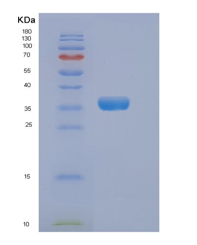Human DKK3 (Dickkopf-Related Protein 3) - Recombinant Protein