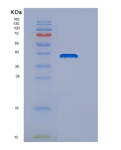 Human DNAJB6 (Dnaj Homolog Subfamily B Member 6) - Recombinant Protein