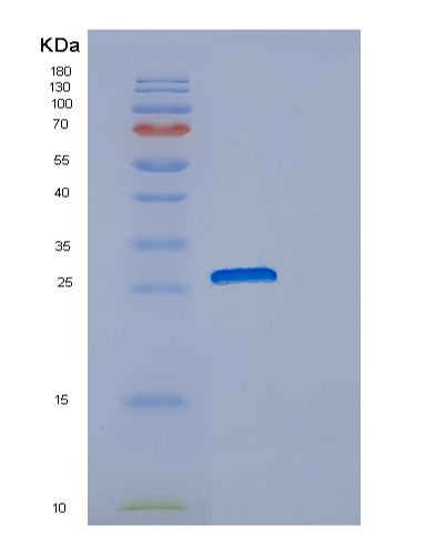 Human DNAJB8 (Dnaj Homolog Subfamily B Member 8) - Recombinant Protein
