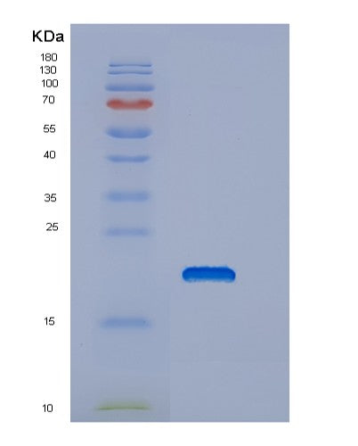 Human DNAJC24 (Dnaj Homolog Subfamily C Member 24) - Recombinant Protein