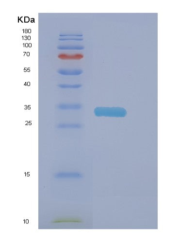 Human DNAJC27 (Dnaj Homolog Subfamily C Member 27) - Recombinant Protein