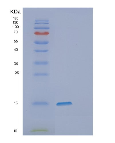 Human DPPA5 (Developmental Pluripotency-Associated 5 Protein) - Recombinant Protein