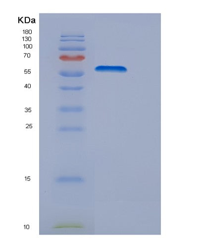 Human DRS (Aspartyl-tRNA synthetase) - Recombinant Protein