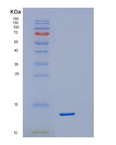 Human RCAN1 (Calcipressin-1) - Recombinant Protein