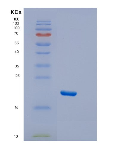 Human DTD2 (D-Aminoacyl-Trna Deacylase 2) - Recombinant Protein