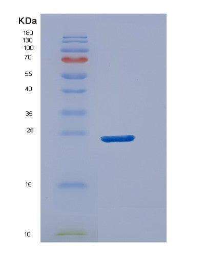 Human DUSP18 (Dual Specificity Protein Phosphatase 18) - Recombinant Protein