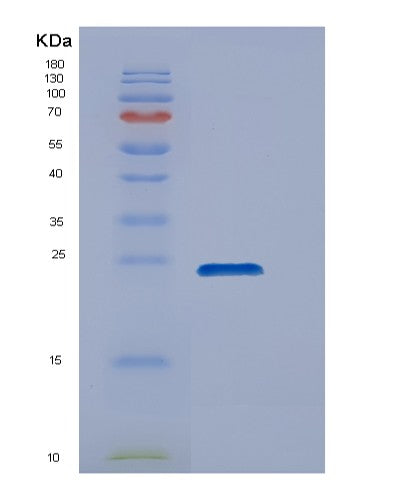 Human DUSP18 (Dual Specificity Protein Phosphatase 18) - Recombinant Protein