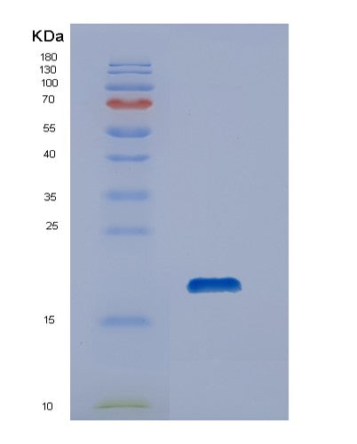 Human DUSP19 (Dual Specificity Protein Phosphatase 19) - Recombinant Protein