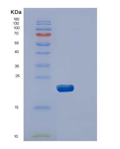 Human DUSP3 (Dual Specificity Protein Phosphatase 3) - Recombinant Protein