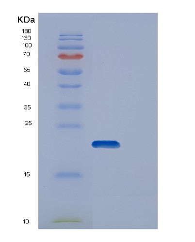 Human DUT (Deoxyuridine 5'-Triphosphate Nucleotidohydrolase, Mitochondrial) - Recombinant Protein