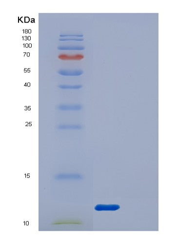 Human DYNLRB1 (Dynein Light Chain Roadblock-Type 1) - Recombinant Protein