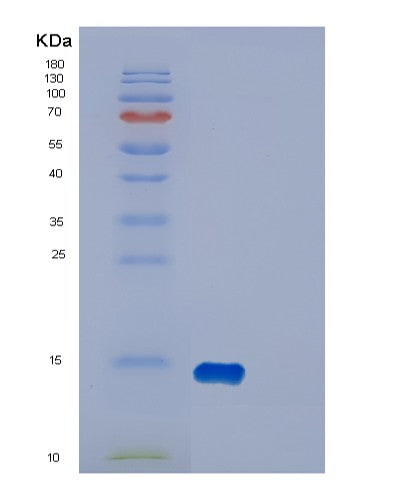 Human DYNLT1 (Dynein Light Chain Tctex-Type 1) - Recombinant Protein