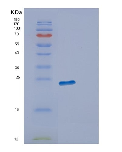 Human ECSIT (Evolutionarily Conserved Signaling Intermediate In Toll Pathway, Mitochondrial) - Recombinant Protein