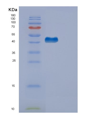 Human EDA2R (Tumor Necrosis Factor Receptor Superfamily Member 27) - Recombinant Protein