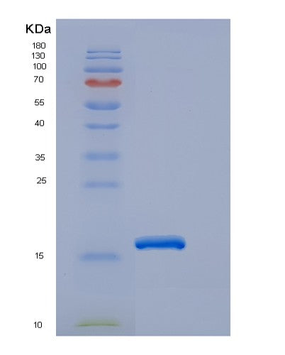 Human EDA2R (Tumor Necrosis Factor Receptor Superfamily Member 27) - Recombinant Protein