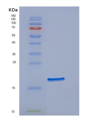 Human EDF1 (Endothelial Differentiation-Related Factor 1) - Recombinant Protein