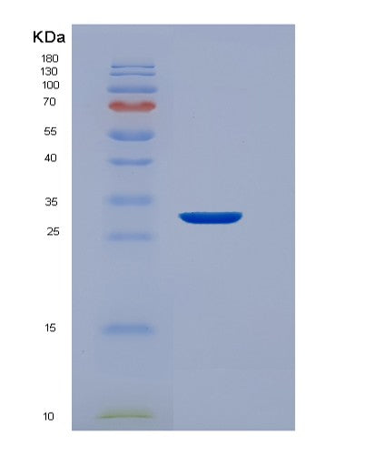 Human EEF1D (Elongation Factor 1-Delta) - Recombinant Protein