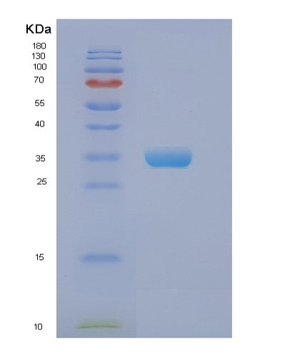 Human EIF2B1 (Translation Initiation Factor Eif2B Subunit Alpha) - Recombinant Protein