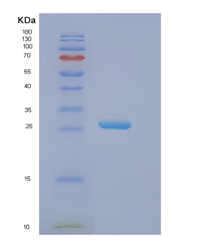 Human EIF3K (Eukaryotic Translation Initiation Factor 3 Subunit K) - Recombinant Protein