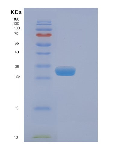 Mouse Eif4e (Eukaryotic Translation Initiation Factor 4E) - Recombinant Protein
