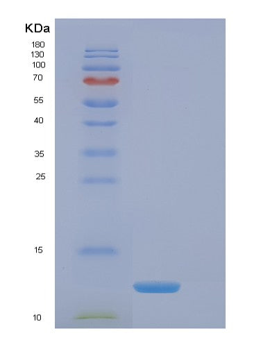 Human EIF4EBP3 (Eukaryotic Translation Initiation Factor 4E-Binding Protein 3) - Recombinant Protein