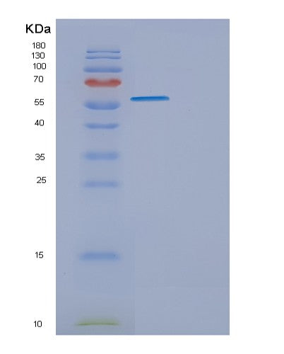 Mouse Eng (Endoglin) - Recombinant Protein