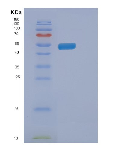 Human ENTPD3 (Ectonucleoside Triphosphate Diphosphohydrolase 3) - Recombinant Protein