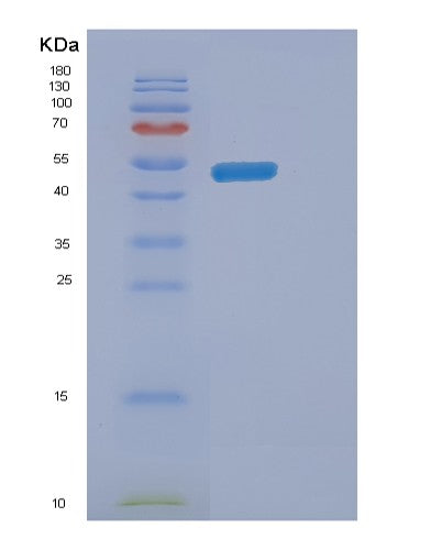 Human ENTPD3 (Ectonucleoside Triphosphate Diphosphohydrolase 3) - Recombinant Protein