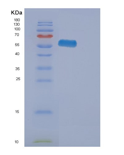 Human EPHA2 (Ephrin Type-A Receptor 2) - Recombinant Protein